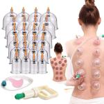 traditional chinese vacuum cupping therapy set - កែវជប់ខ្យល់១ឈុត